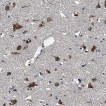 Anti-TMED2 antibody produced in rabbit，100UL，HPA014060-100UL，Sigma