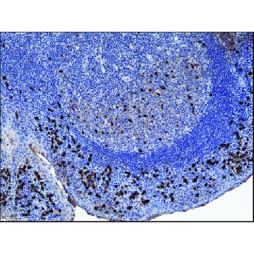 Anti-Human IgA1 antibody, Rabbit monoclonal，100UG，SAB5600217-100UG，Sigma