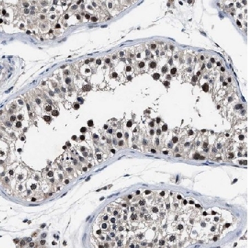 Anti-USP16 antibody produced in rabbit，100UL，HPA021140-100UL，Sigma