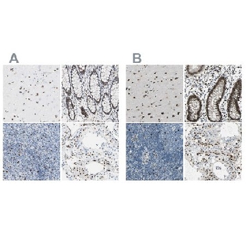 Anti-NFIA antibody produced in rabbit，100UL，HPA008884-100UL，Sigma