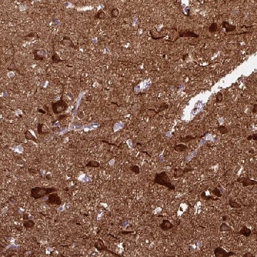 Anti-CAMK2A antibody produced in rabbit，100UL，HPA051783-100UL，Sigma