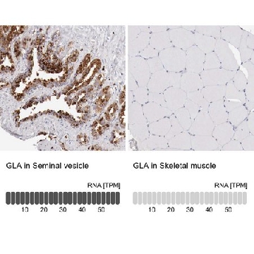 抗-GLA 兔抗，100UL，HPA000237-100UL，Sigma