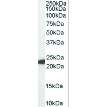 Anti-Glutathione peroxidase 1 (ISO1) antibody produced in goat，100UG，SAB2500468-100UG，Sigma