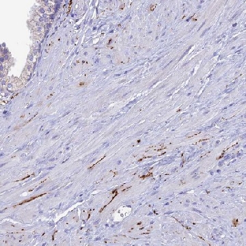 Anti-NPY antibody produced in rabbit，100UL，HPA044572-100UL，Sigma