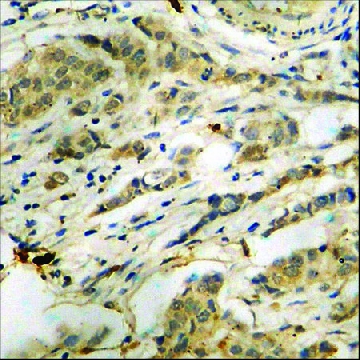 Anti-phospho-PKR (pThr⁴⁴⁶) antibody produced in rabbit，100UG，SAB4504517-100UG，Sigma