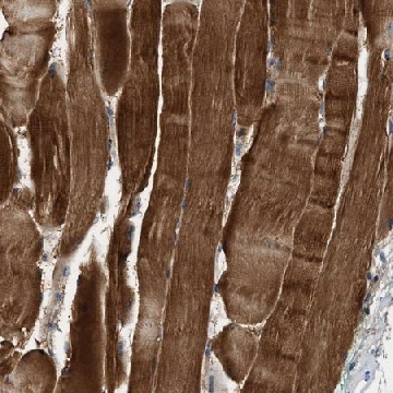 Anti-ZCCHC6 antibody produced in rabbit，100UL，HPA020620-100UL，Sigma