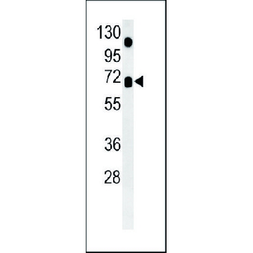 ANTI-ASB15 (CENTER) antibody produced in rabbit，400UL，SAB1304184-400UL，Sigma