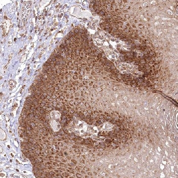 Anti-OTUD4 antibody produced in rabbit，100UL，HPA036623-100UL，Sigma