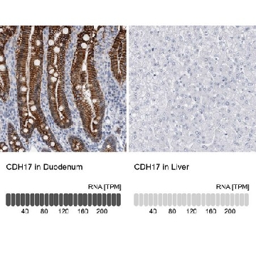 Anti-CDH17 antibody produced in rabbit，100UL，HPA023616-100UL，Sigma
