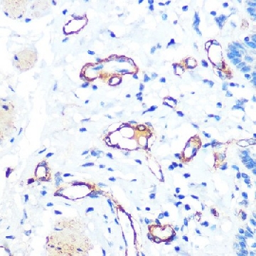 Anti-VWF antibody produced in rabbit，100UL，SAB5701056-100UL，Sigma