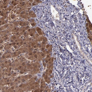 Anti-SERPINF2 antibody produced in rabbit，100UL，HPA001885-100UL，Sigma