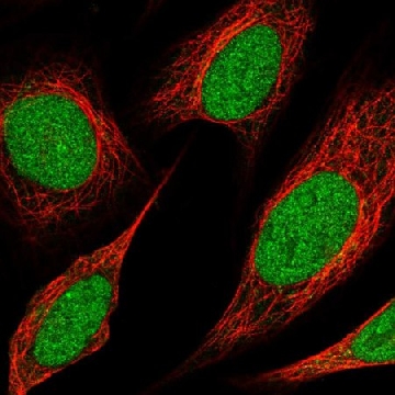 Anti-Kmt2C Antibody Produced In Rabbit，1004G，HPA062814-100UL，Sigma
