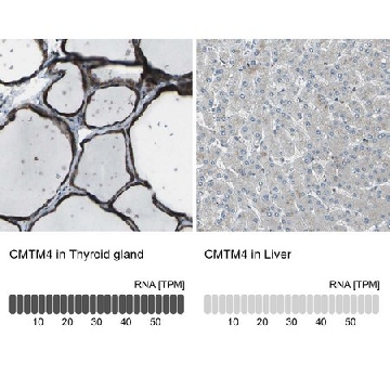 抗-CMTM4 兔抗，100UL，HPA014704-100UL，Sigma