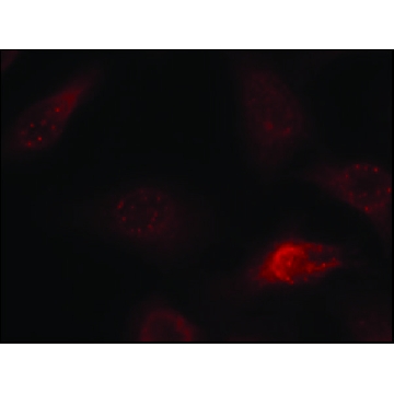 Anti-APP (Ab-668) antibody produced in rabbit，100UG，SAB4300464-100UG，Sigma