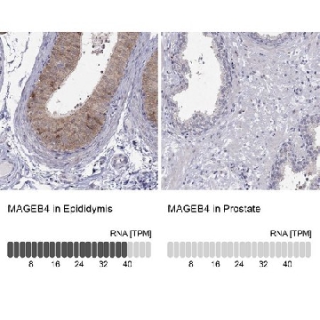 Anti-MAGEB4 antibody produced in rabbit，100UL，HPA030456-100UL，Sigma
