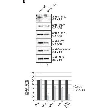 Anti-TIMM29 antibody produced in rabbit，100UL，HPA041858-100UL，Sigma