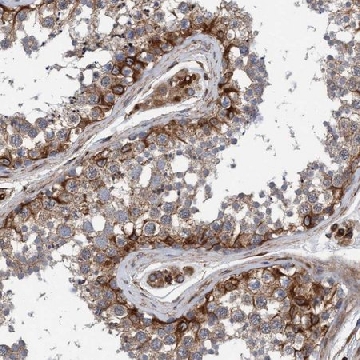 Anti-STXBP4 antibody produced in rabbit，100UL，HPA022888-100UL，Sigma