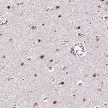 Anti-HNRNPDL antibody produced in rabbit，100UL，HPA063147-100UL，Sigma