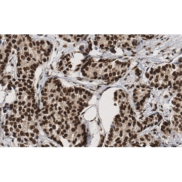 Anti-53BP1 Antibody, clone BP13 ZooMAb® Mouse Monoclonal，25UL，ZMS1044-25UL，Sigma