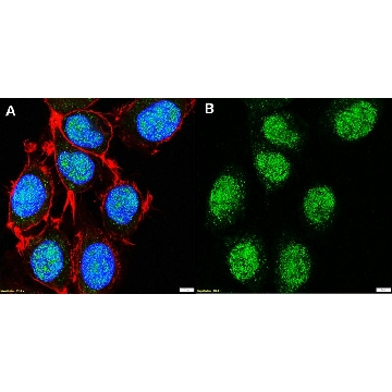 Anti-SETD5 Antibody, clone 3B22 ZooMAb® Rabbit Monoclonal，254G，ZRB2210-25UL，Sigma