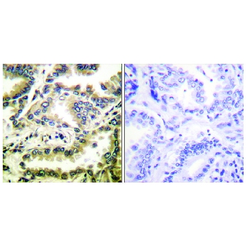 Anti-NF-κB p65 (Acetyl-Lys³¹⁰) antibody produced in rabbit，100UG，SAB4502616-100UG，Sigma