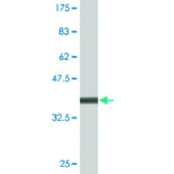 Monoclonal Anti-ATP7B, (C-terminal) antibody produced in mouse，100UG，SAB1403592-100UG，Sigma
