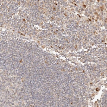 Anti-PTPN22 antibody produced in rabbit，100UL，HPA004912-100UL，Sigma