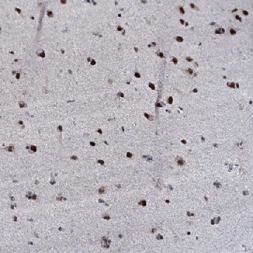 Anti-ZMIZ2 antibody produced in rabbit，100UL，HPA040716-100UL，Sigma