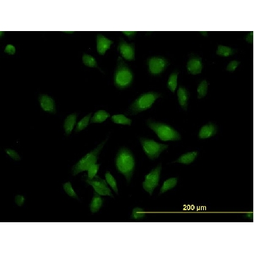 Monoclonal Anti-ATP2C1 antibody produced in mouse，100UG，WH0027032M1-100UG，Sigma