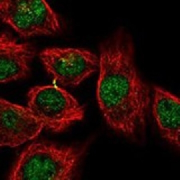 Anti-KCTD1 antibody produced in rabbit，100UL，HPA057808-100UL，Sigma
