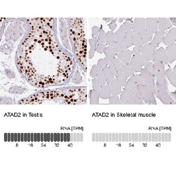 Monoclonal Anti-ATAD2 antibody produced in mouse，100UL，AMAB90541-100UL，Sigma