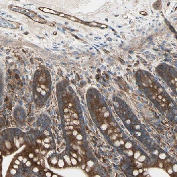 Anti-IGSF9B antibody produced in rabbit，100UL，HPA010802-100UL，Sigma