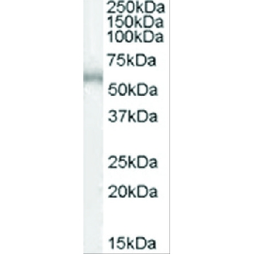 抗-ADRB1 山羊抗，100UG，SAB2500034-100UG，Sigma