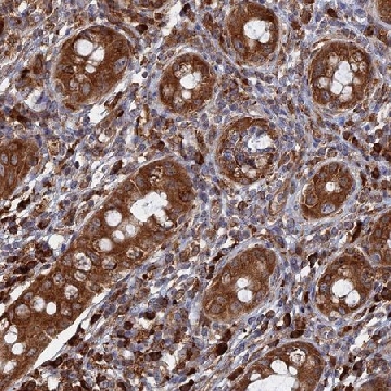 Anti-BPIFB6 antibody produced in rabbit，100UL，HPA043057-100UL，Sigma