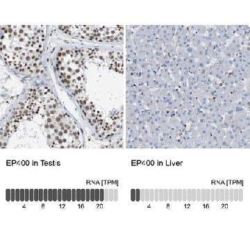 Anti-EP400 antibody produced in rabbit，100UL，HPA016704-100UL，Sigma