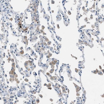 Anti-HEG1 antibody produced in rabbit，100UL，HPA011559-100UL，Sigma