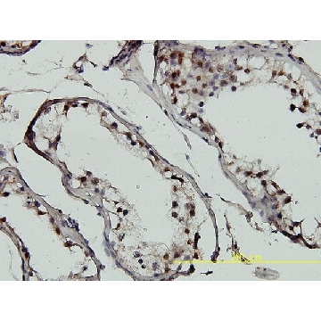 Monoclonal Anti-GTF2H1 antibody produced in mouse，100UG，WH0002965M1-100UG，Sigma
