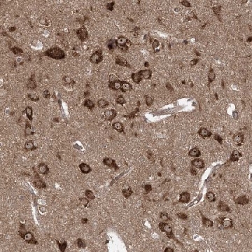 Anti-SERINC1 antibody produced in rabbit，100UL，HPA035738-100UL，Sigma