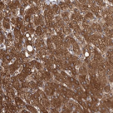 Anti-CTBS antibody produced in rabbit，100UL，HPA023594-100UL，Sigma