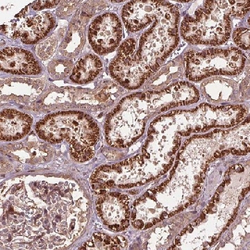 Anti-CEP95 antibody produced in rabbit，100UL，HPA061371-100UL，Sigma