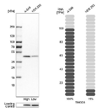 Anti-TMOD3 antibody produced in rabbit，100UL，HPA001849-100UL，Sigma