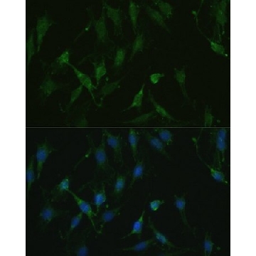Anti-TRPV1 antibody produced in rabbit，100UL，SAB5700857-100UL，Sigma