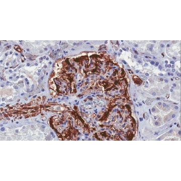 抗Wilms′瘤抗体，NT，克隆6F-H2，无腹水，100UG，MAB4234-C，Sigma