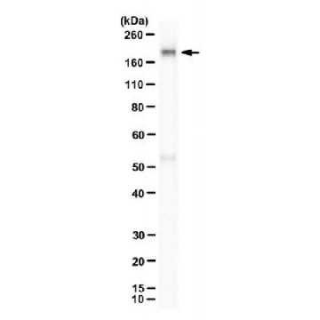 Anti-CFAP43 Antibody, clone 27D5，25UL，MABT1562-25UL，Sigma