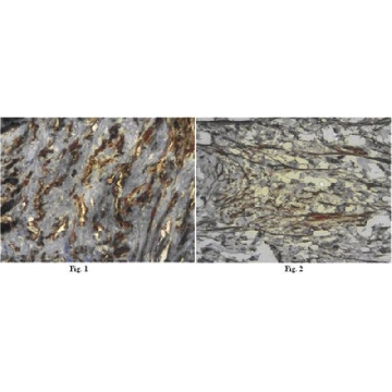Anti-Integrin beta-3 Antibody，100UG，AB2984，Sigma