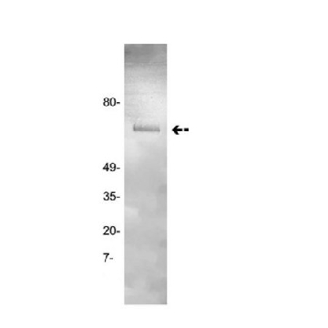 Anti-Prothrombin Antibody, clone GMA-095，100UG，05-879，Sigma
