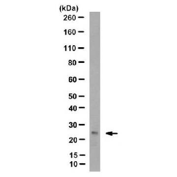 Anti-Ubiquitinated Histone H2B (Lys123) Antibody, clone 1B3F12/A9，100UG，MABE1785，Sigma