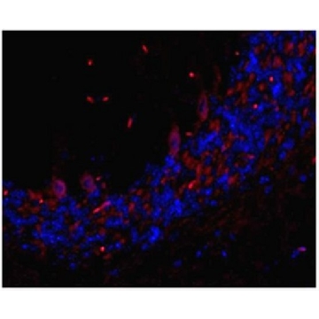 Anti-TMEM106B Antibody, clone TME-N 6F2，100UG，MABN473，Sigma