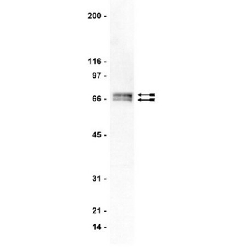 Anti-GRK 4-6 Antibody, clone A16/17，200UG，05-466，Sigma