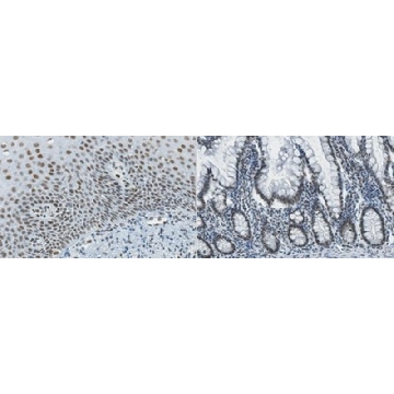 Anti-REST Antibody, clone 2D9.1，25UG，MABC1560-25UG，Sigma
